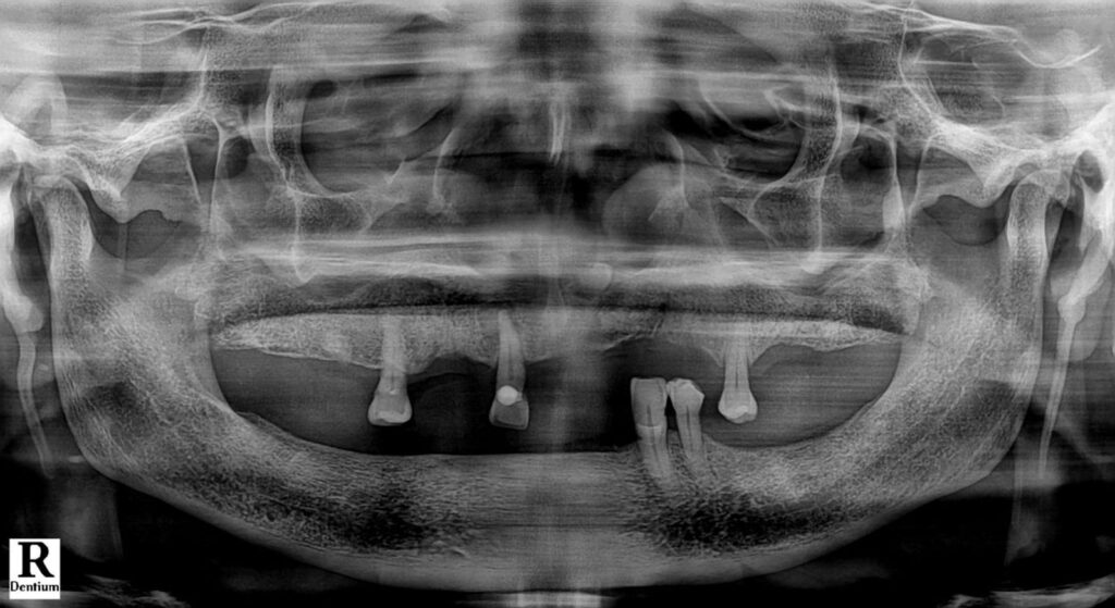 Please upload your X-rays