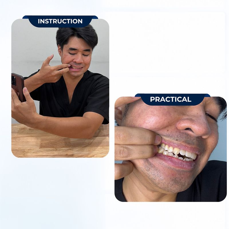 Right side of your bite