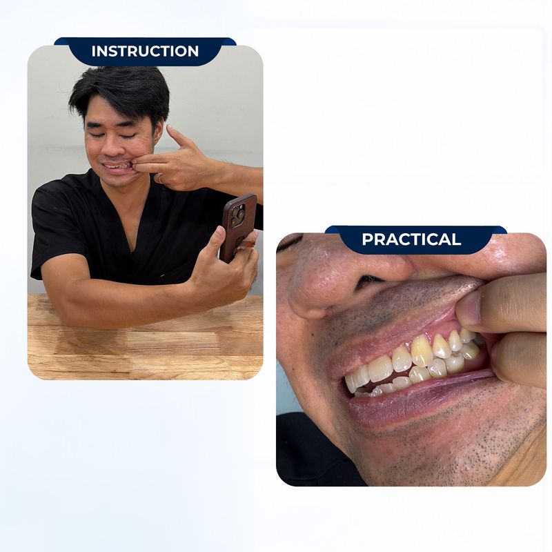 Left side of your bite