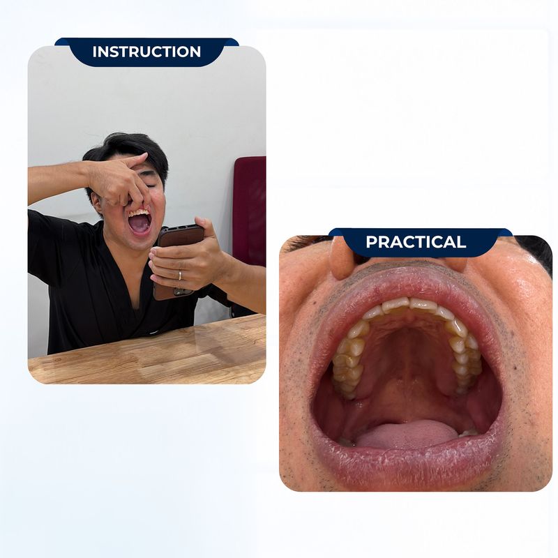 Please upload clear photos of your teeth and smile.