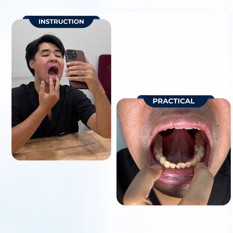 Please upload clear photos of your teeth and smile.