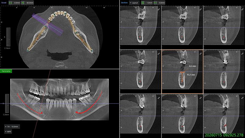 Others X-rays/Photos